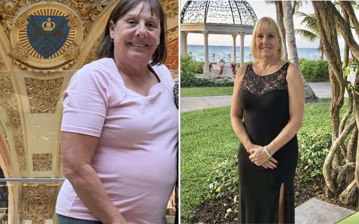 A SlimFit patient before and after her medical weight loss program